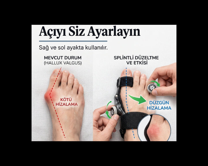 Ayak Baş Parmak Kemik düzeltici (hallug valgus)